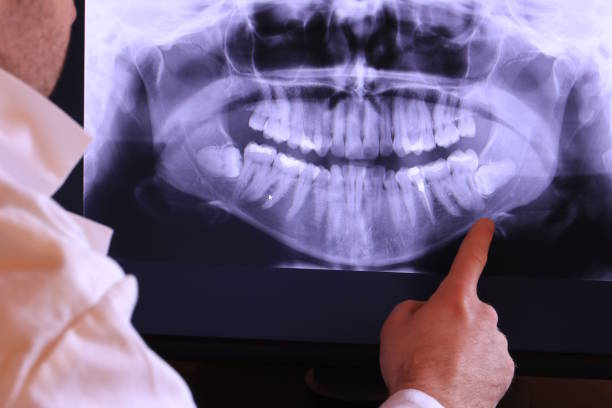 Best Emergency Treatment for Jaw Pain or Injury in Egypt Lake Leto, FL
